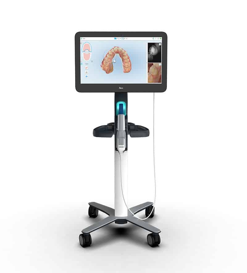 iTero Digital Scanner